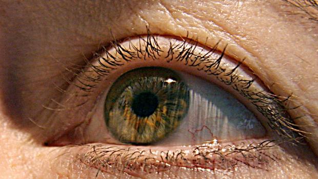 Ojo de una persona con una enfermedad oftalmológica