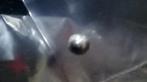 Imagen de la bala extraída del cuello al operario