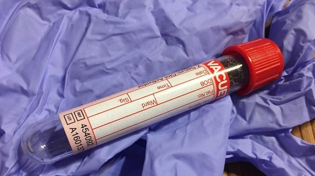 Un análisis de sangre para detectar el riesgo cardiaco
