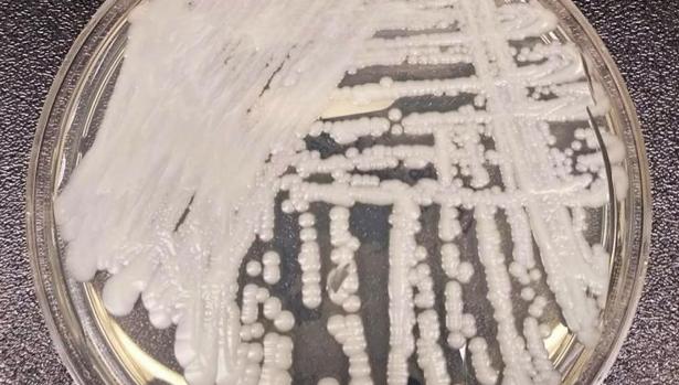 Una cepa de Candida auris cultivada en una placa de Petri en los Centros para el Control y la Prevención de Enfermedades (CDC)