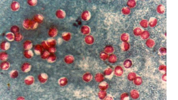 Bacteria de la diarrea