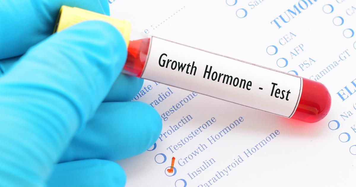 20 hormona del crecimiento precio españa de palabra clave que nunca debe cometer Cómo mejoramos nuestra hormona del crecimiento precio españa en un mes